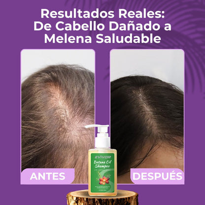 Shampoo Batana Oil