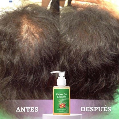 Shampoo Batana Oil