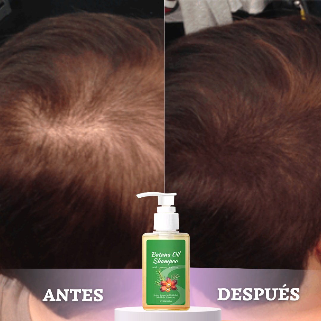 Shampoo Batana Oil